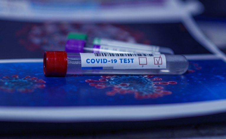 Nie brakuje chętnych na płatne testy na koronawirusa
