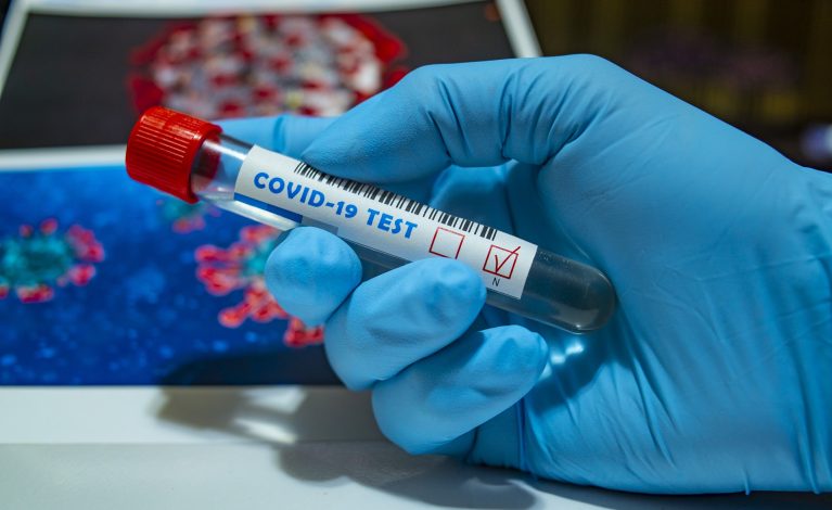 Potwierdzono 16 przypadków indyjskiego wariantu koronawirusa